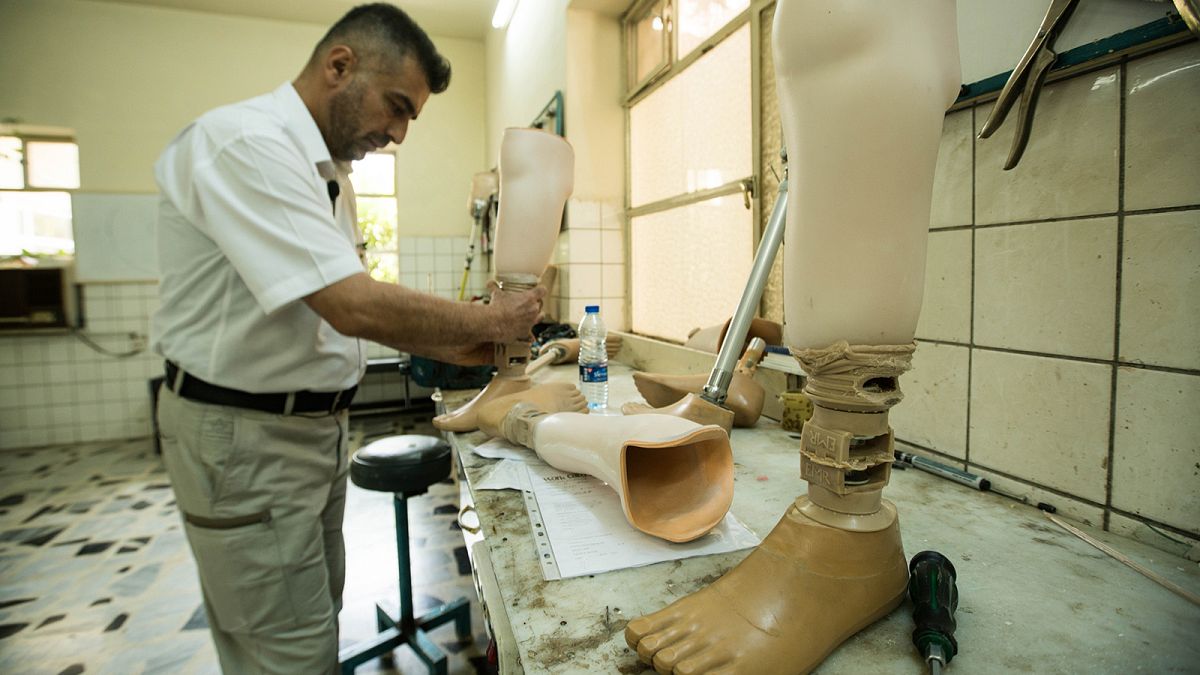 In Mossul warten mehr als 4500 Menschen auf eine Prothese