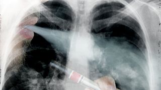 دراسة تظهر تأثير مدمّر للسجائر الألكترونية على الأوعية الدموية والقلب