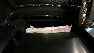 Stampa 3D di organi ed arti, la nuova frontiera della medicina