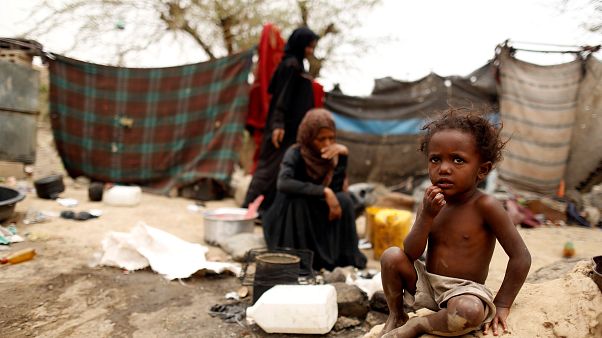 Yemen'de kolera salgını binlerce can aldı Yemen'de kolera salgını binlerce can aldı