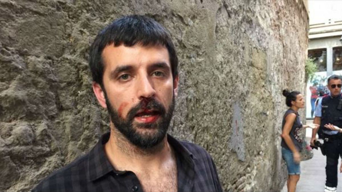 Un photojournaliste agressé au cri de "Viva Franco"