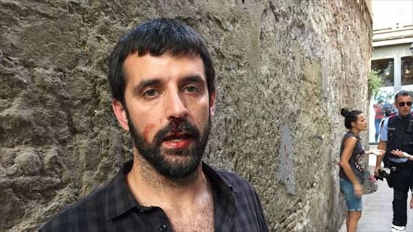 Un photojournaliste agressé au cri de "Viva Franco" Un photojournaliste agressé au cri de "Viva Franco"