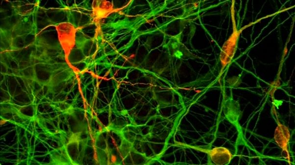 Parkinson: via alla sperimentazione con le staminali sugli esseri umani Parkinson: via alla sperimentazione con le staminali sugli esseri umani