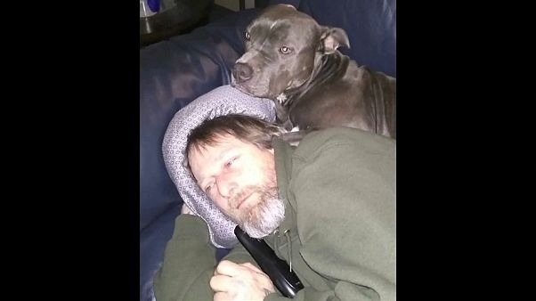 Homem amputado após lambidela de cão Homem amputado após lambidela de cão