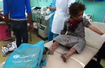 Йемен: смертоносное нападение на автобус с детьми