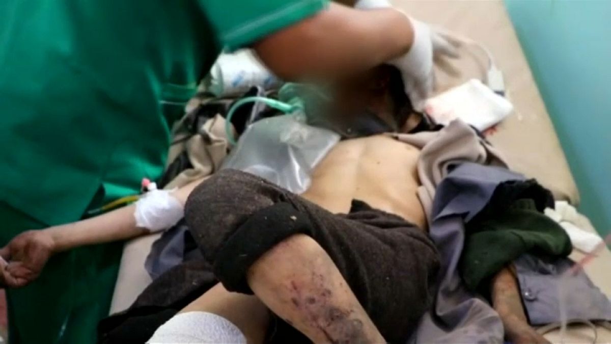 Mueren 29 niños en un bombardeo en Yemen