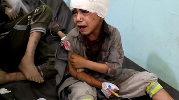 UNICEF: Yemen'de 2 bin 400 çocuk öldü UNICEF: Yemen'de 2 bin 400 çocuk öldü