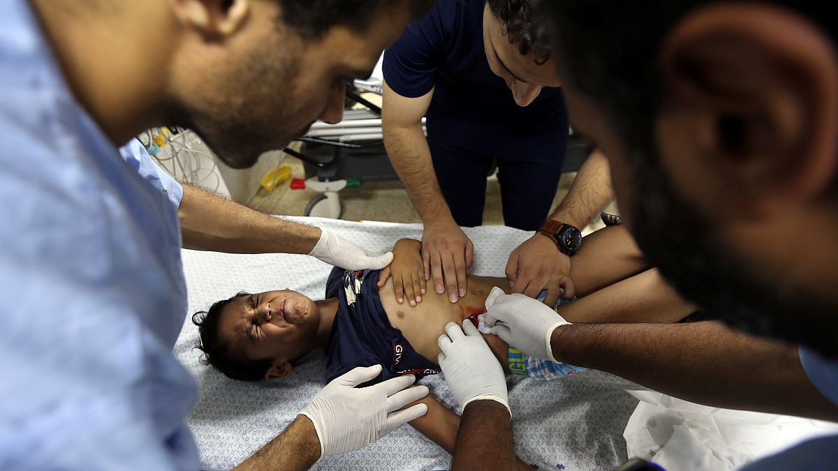 Sérült kisgyereket látnak el egy gázai kórházban