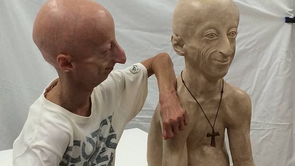 Sammy Basso: El italiano de 22 años que parece un anciano Sammy Basso: El italiano de 22 años que parece un anciano