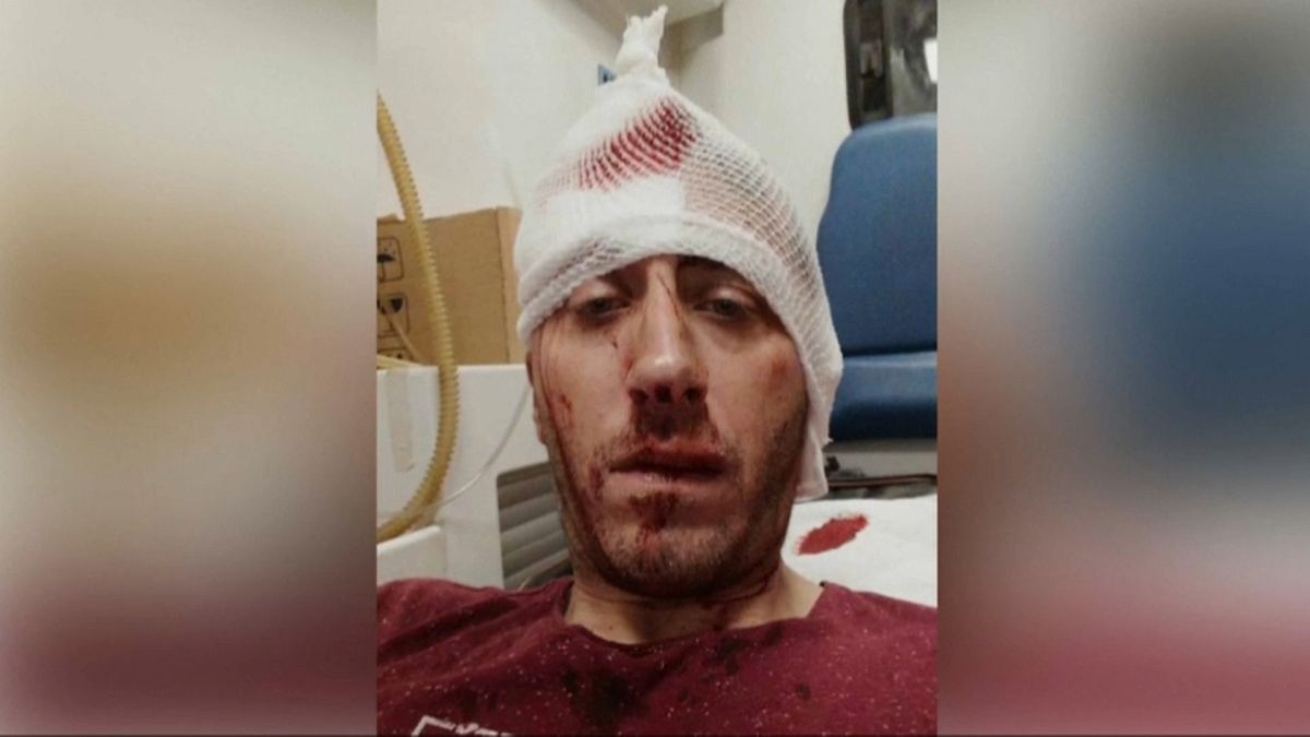 Fernsehreporter Kovacevic liegt nach Prügelattacke im Krankenhaus