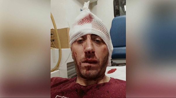 Nach Prügelattacke auf Reporter: Bosnische Journalisten demonstrieren Nach Prügelattacke auf Reporter: Bosnische Journalisten demonstrieren