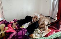 In photos: Suffering from cancer amid war in Yemen