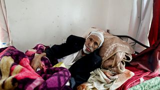 In photos: Suffering from cancer amid war in Yemen