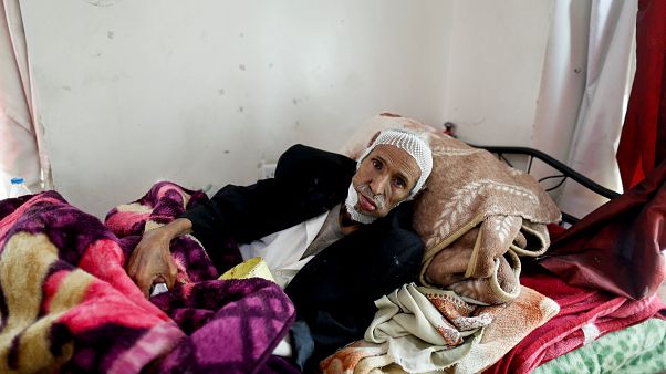In photos: Suffering from cancer amid war in Yemen In photos: Suffering from cancer amid war in Yemen