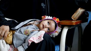 معاناة مرضى السرطان في اليمن... وجه آخر للحرب