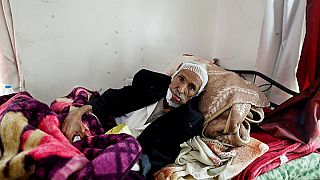 رنج بیماران سرطانی در بحبوحه جنگ یمن به روایت تصویر