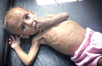 1600 gyermek hal éhen minden nap a háborús zónákban idén