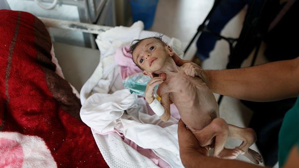 UNICEF: Yemen savaşı çocuklar için canlı bir cehennem UNICEF: Yemen savaşı çocuklar için canlı bir cehennem