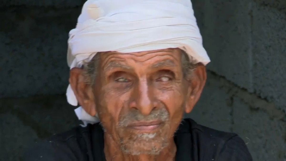 Genetik bozukluk Yemen'de bir köyü kör etti