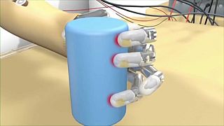 Una mano bionica sempre più "intelligente"