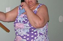 البدينات أكثرعرضة للإصابة بسلس البول