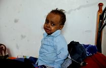 Tízből hét ember nem fertőző betegségekben hal meg a világon