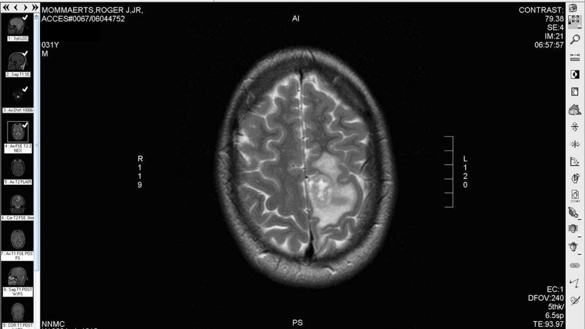 Images from MRI