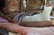 Civilian casualties soar in Yemen’s Hodeidah 