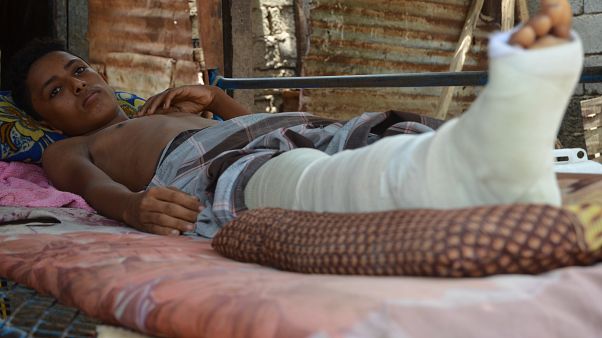 Alarmante aumento del número de víctimas civiles en Yemen Alarmante aumento del número de víctimas civiles en Yemen