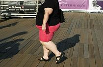 İngiltere'de kadınlarda kanserin başlıca nedeni sigara değil obezite olacak