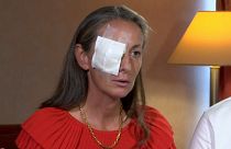 Ryder Cup, parla la donna ferita: "Inaccettabile quanto accaduto"