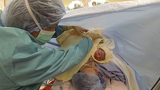 الأطباء يحذرون من "وباء" الولادات القيصرية في العالم.. مصر وإيران كمثال