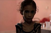 11 milhões de crianças em risco no Iémen