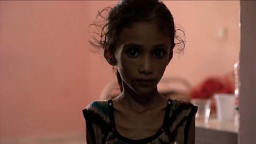 11 milhões de crianças em risco no Iémen