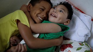Daniel Vieira, de dos años, nacido con microcefalia, junto a su hermano.