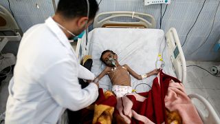 Bir insanlık dramı: Yemen'de 'görülmemiş açlık' kapıda