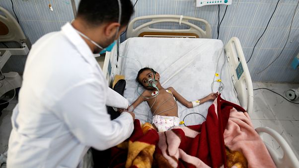 Bir insanlık dramı: Yemen'de 'görülmemiş açlık' kapıda Bir insanlık dramı: Yemen'de 'görülmemiş açlık' kapıda