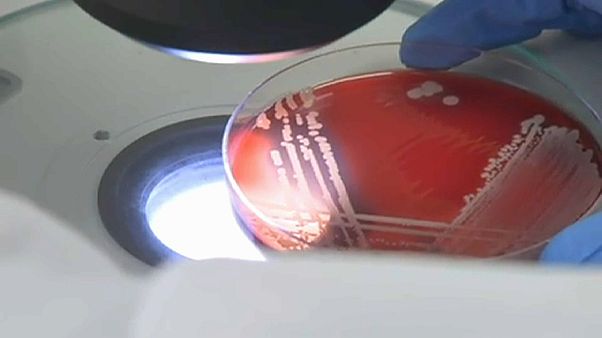 Bacteria studied under a microscope for antibiotic resistant strains Bacteria studied under a microscope for antibiotic resistant strains