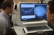 Como é que a mais recente tecnologia ótica pode melhorar o diagnóstico de patologias dos olhos?
