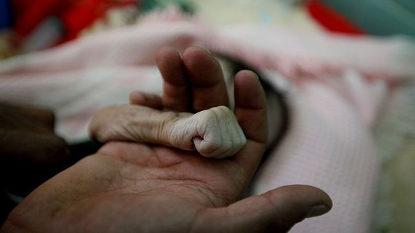 Yemen'de açlıktan dolayı ölen 4 aylık bebek Yemen'de açlıktan dolayı ölen 4 aylık bebek