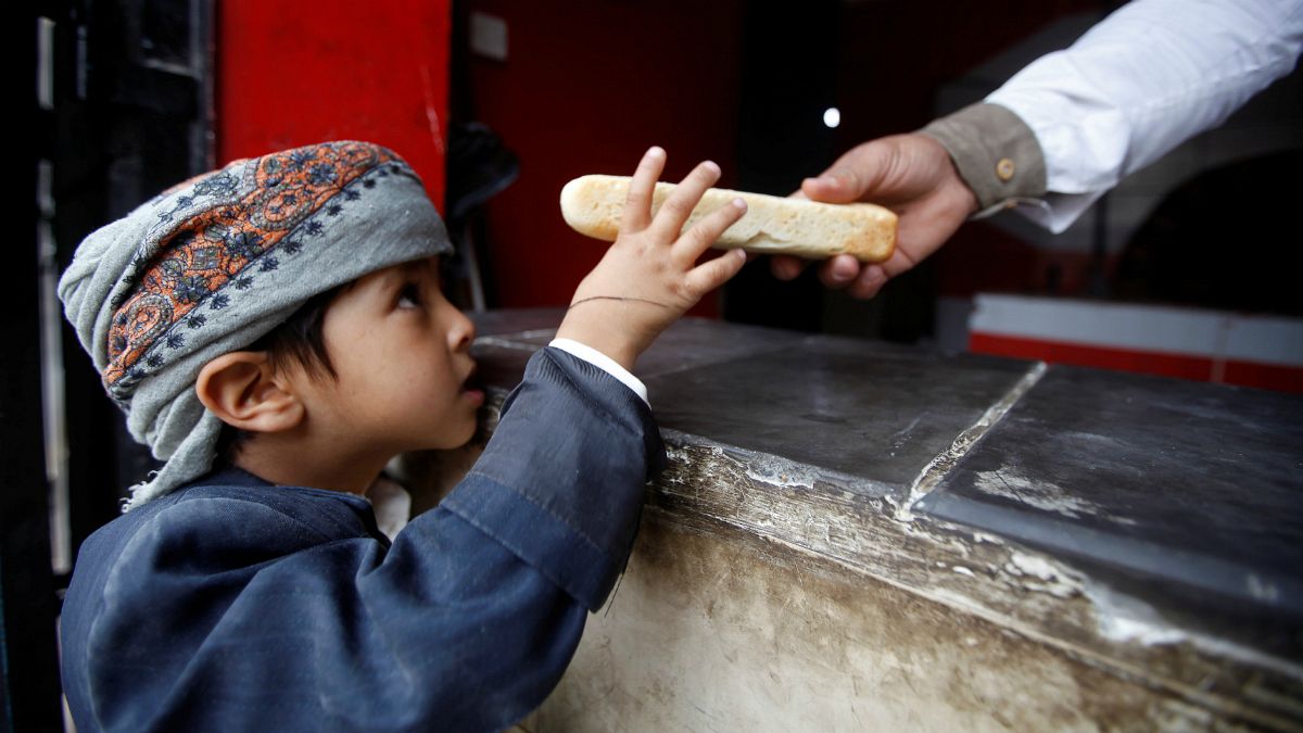 روز جهانی کودک؛ ۲۰۰ هزار کودک یمنی سوءتغذیه دارند