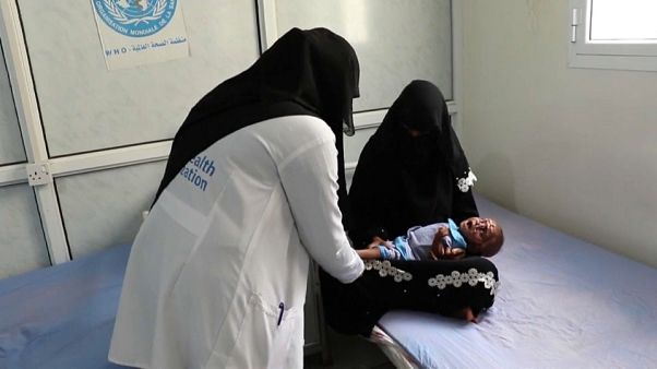 Yemen’de kıtlıktan dolayı 85 bin çocuk yaşamını yitirdi Yemen’de kıtlıktan dolayı 85 bin çocuk yaşamını yitirdi