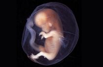 نخستین نوزادان مقاوم به آچ‌آی‌وی حاصل از مهندسی ژنتیک در چین به دنیا آمدند