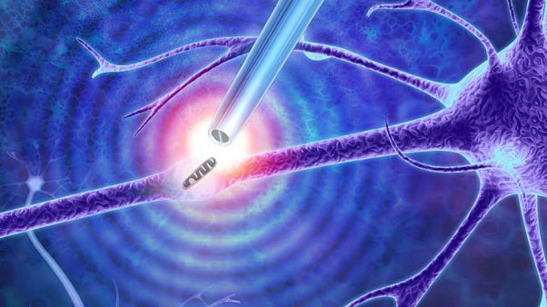 Tıpta yeni keşiflerin kapısını açacak olan alet: Nano-cımbız Tıpta yeni keşiflerin kapısını açacak olan alet: Nano-cımbız