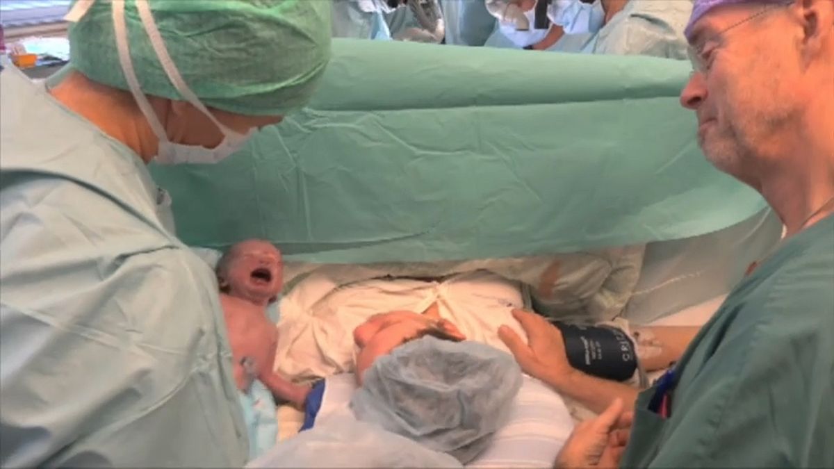 Un bébé naît après une greffe d'utérus provenant d'une donneuse morte