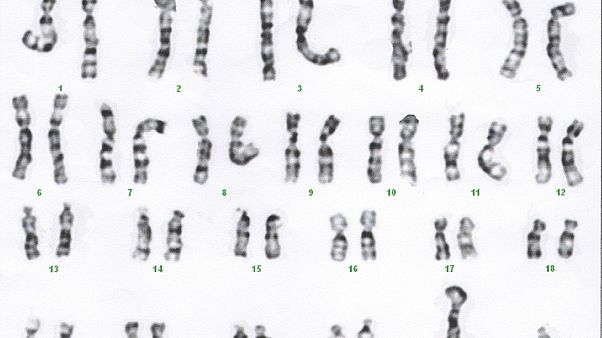 Karyotype Karyotype