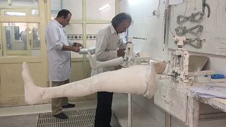 Video | İtalyan fizyoterapist, Afganistan’daki mayın mağdurlarının derdine derman oluyor