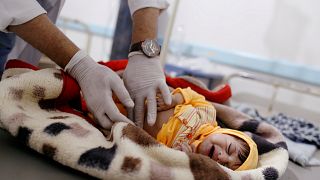 باحثون يتمكنون من تحديد مصدر وباء الكوليرا المتفشي في اليمن