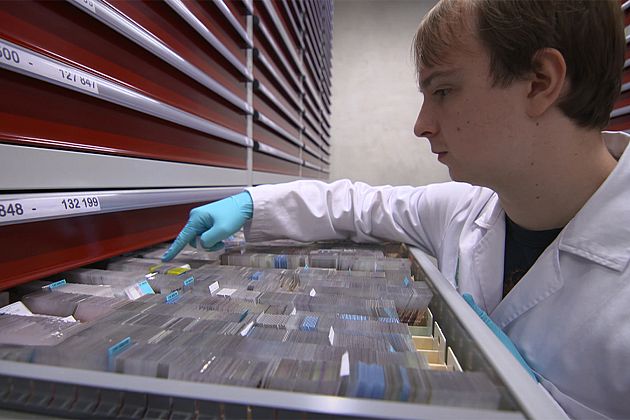 ایجاد زیست‌بانک‌های نمونه‌ یاخته‌های سرطانی چه کمکی به پزشکان می‌کند؟