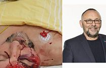 Ξυλοκοπήθηκε βουλευτής του ακροδεξιού AfD